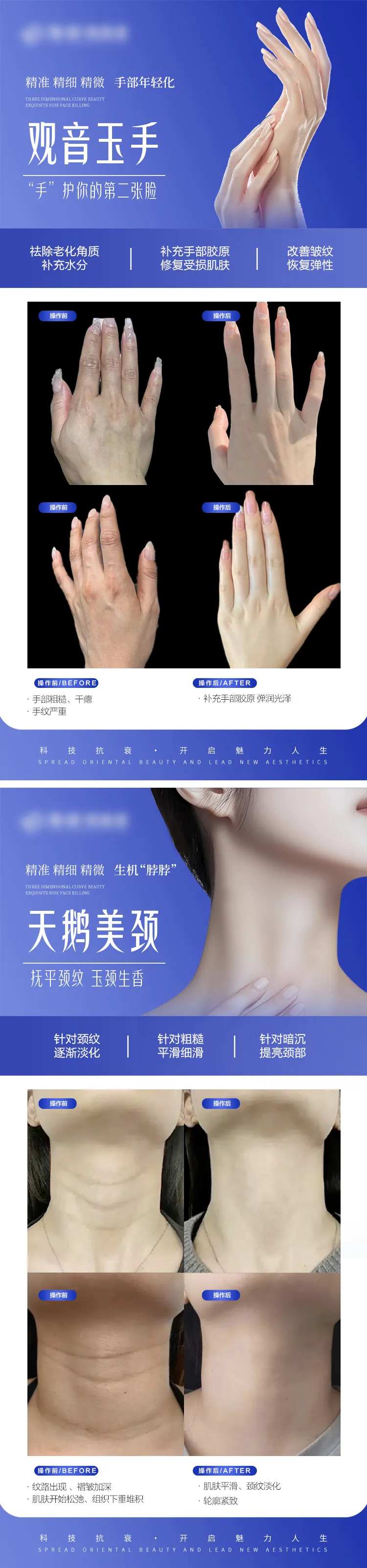 医美手部颈部抗衰案例对比宣传系列海报-采灵感-cailinggan.com