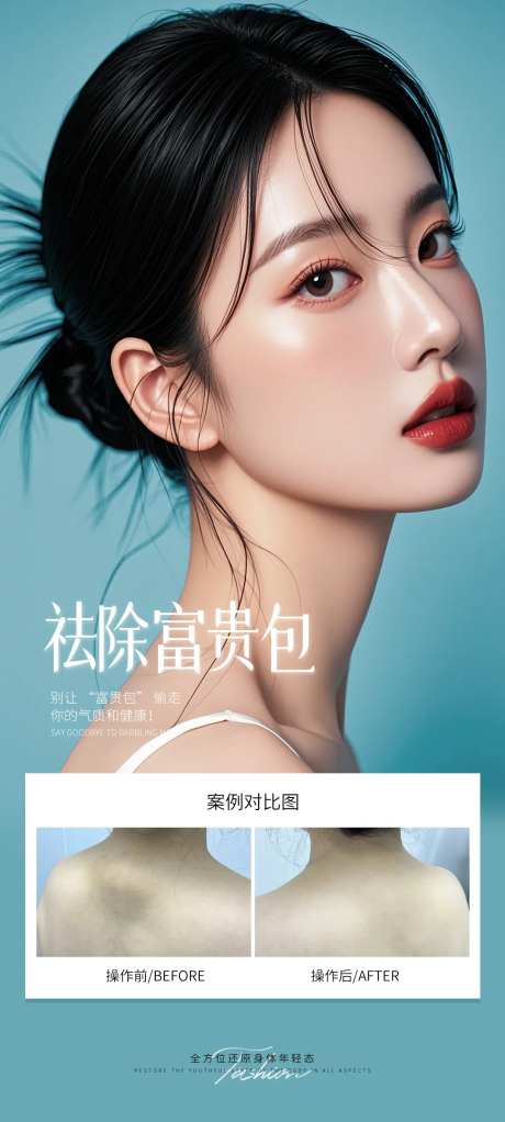 消除富贵包-采灵感-https://www.cailinggan.com/