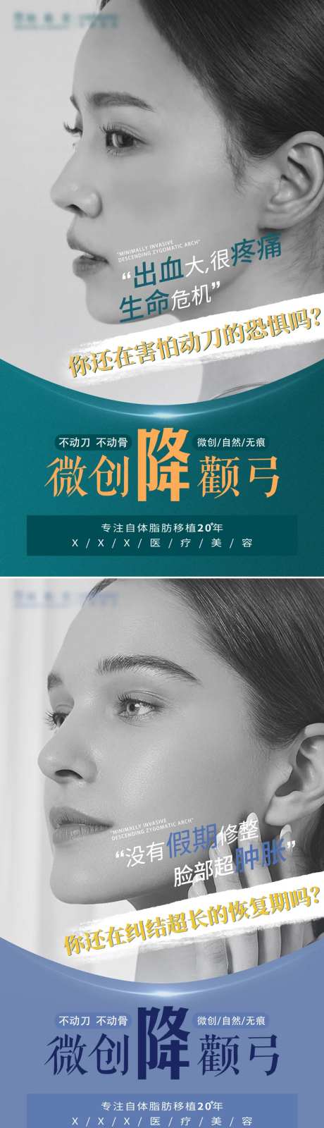 医美降颧骨海报-采灵感-https://www.cailinggan.com/