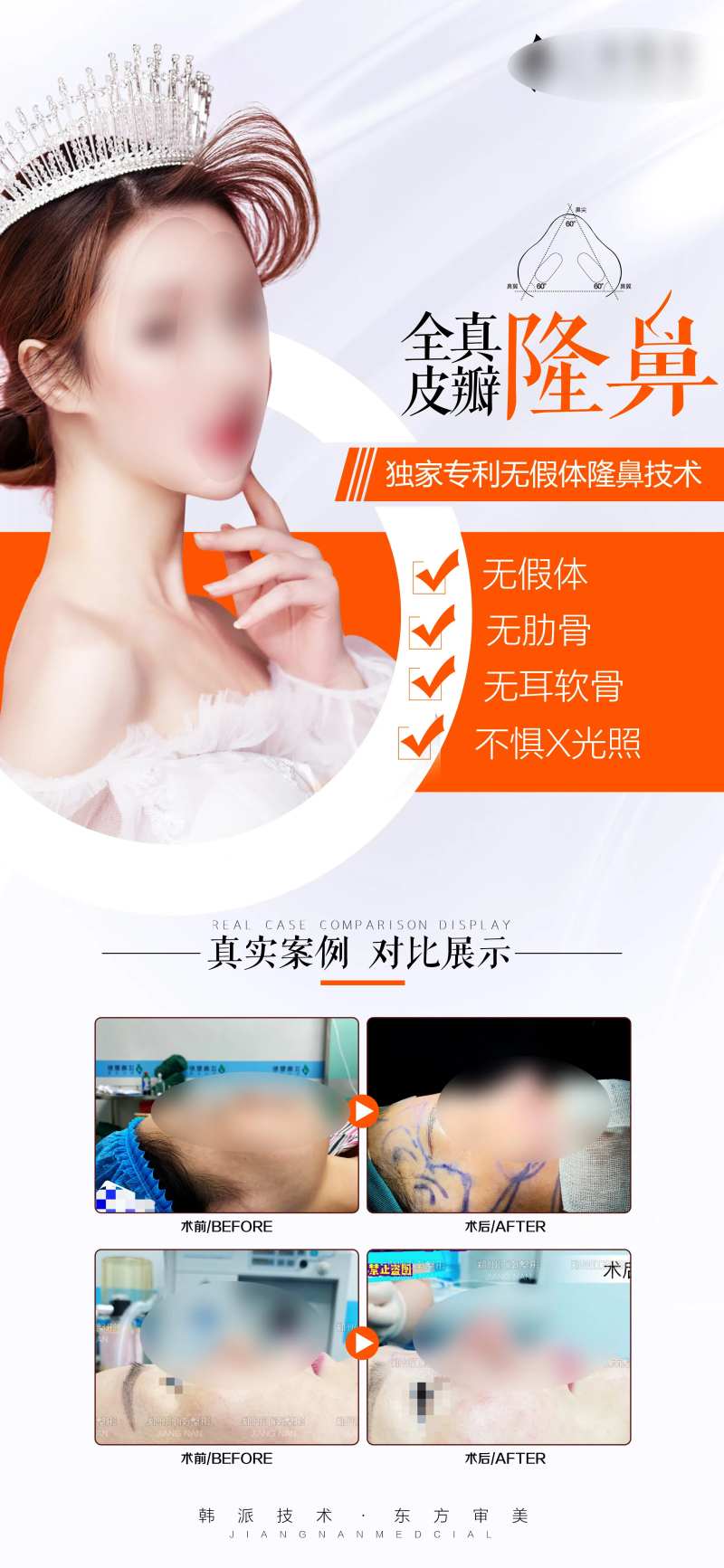 医美高端双隆鼻鼻综合海报长图-采灵感-cailinggan.com