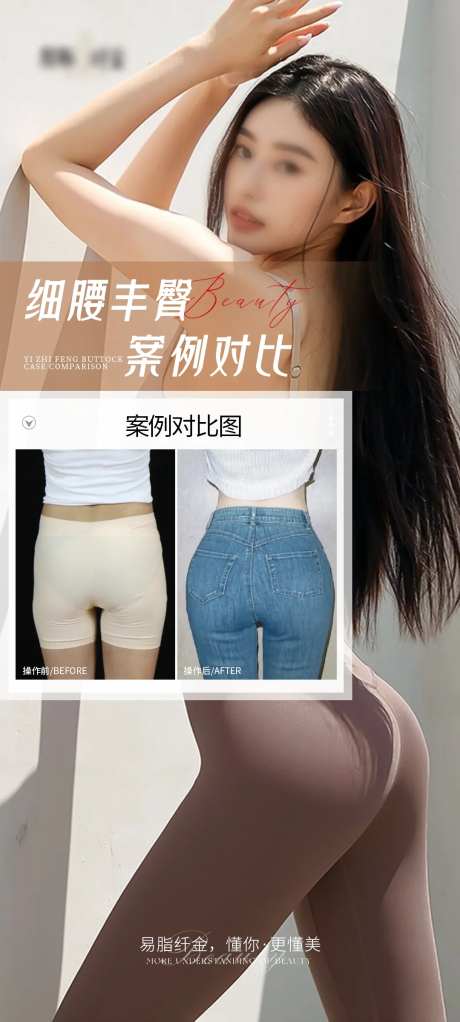医美丰臀案例对比海报-采灵感-https://www.cailinggan.com/