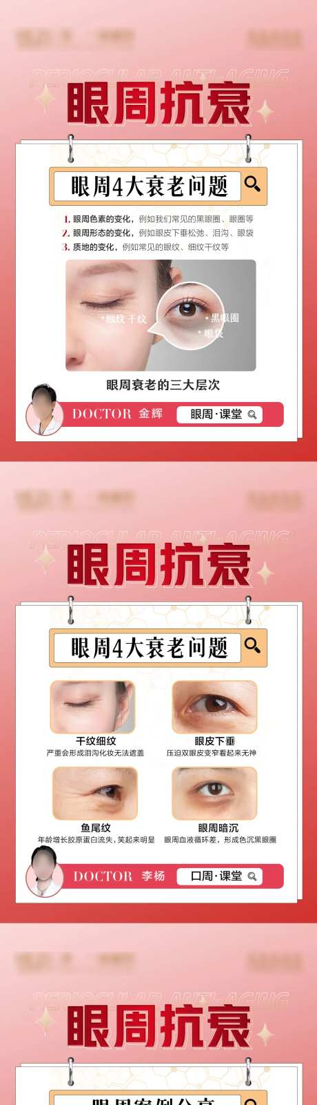整形眼周抗衰海报-采灵感-https://www.cailinggan.com/
