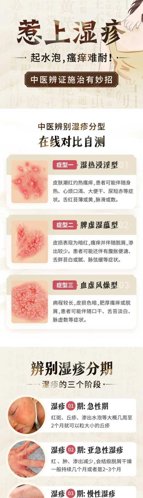 中医治疗湿疹百度专题页落地页-采灵感-https://www.cailinggan.com/