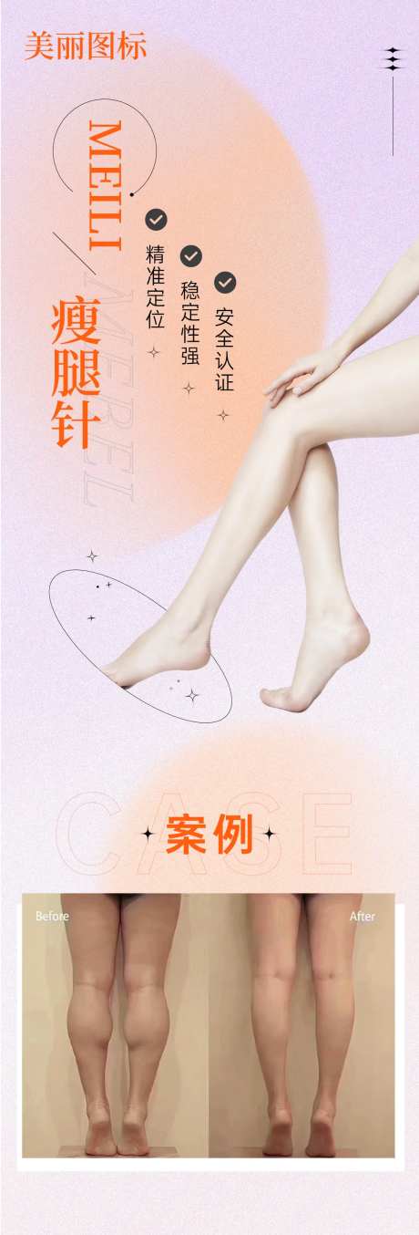 医美瘦腿针案例-采灵感-https://www.cailinggan.com/