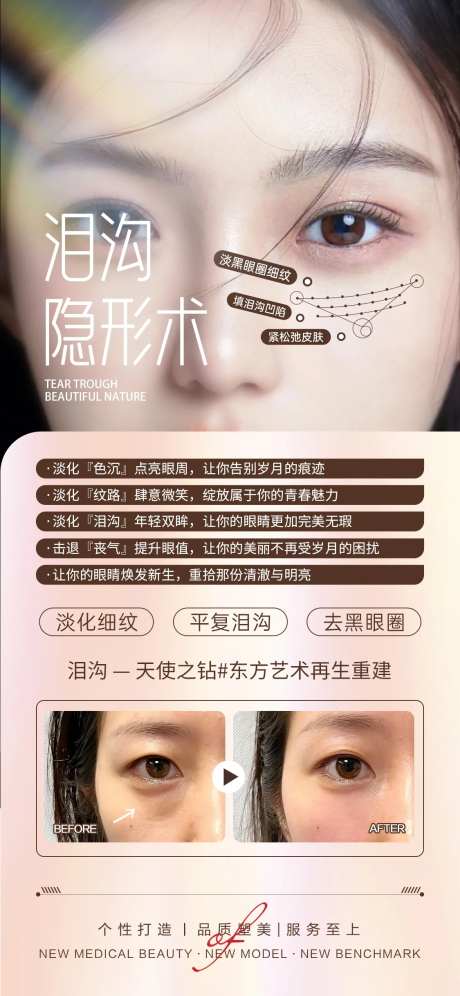 医美泪沟填充案例对比-采灵感-https://www.cailinggan.com/