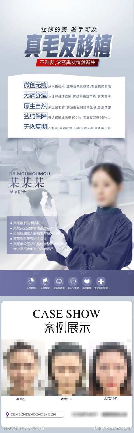 毛发移植案例-采灵感-https://www.cailinggan.com/