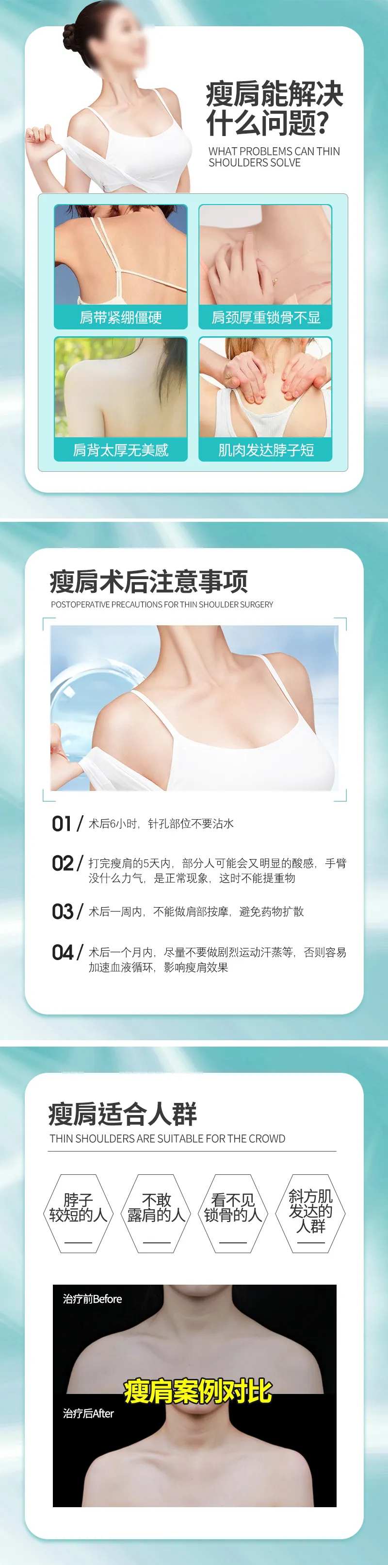 瘦肩术后科普海报-采灵感-cailinggan.com