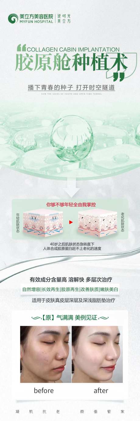 医美整形胶原舱种植术长图-采灵感-https://www.cailinggan.com/