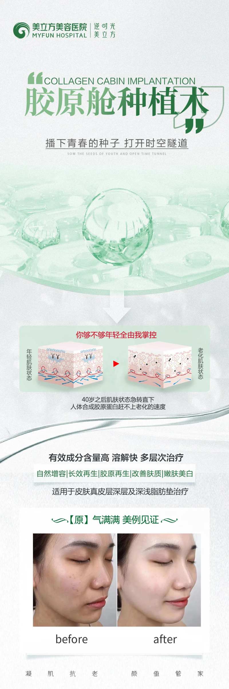 医美整形胶原舱种植术长图-采灵感-cailinggan.com