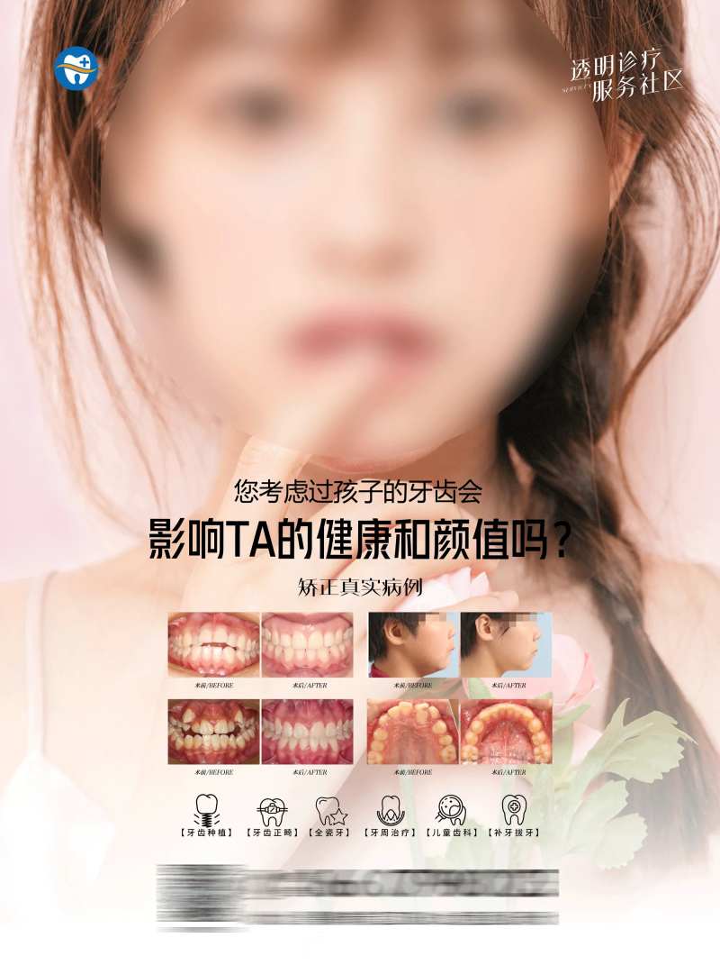 口腔案例电梯海报-采灵感-cailinggan.com