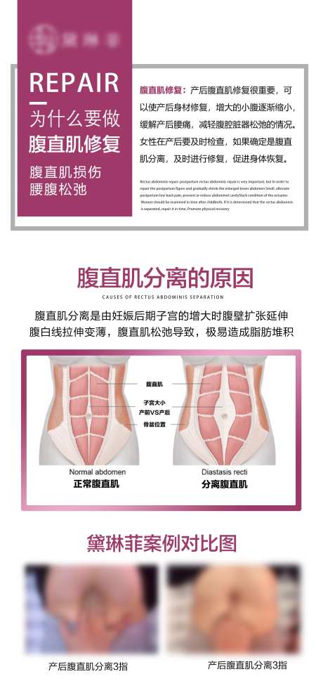 私密产后修复海报-采灵感-https://www.cailinggan.com/