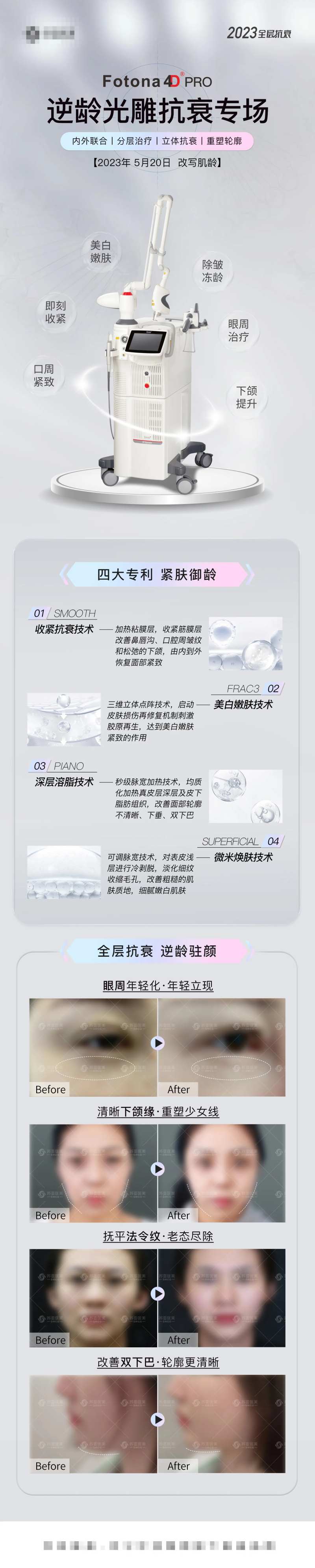 医美FOTONA 4DPro长图-采灵感-cailinggan.com