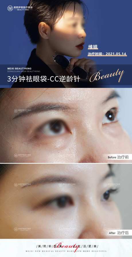 CC逆龄针-采灵感-https://www.cailinggan.com/