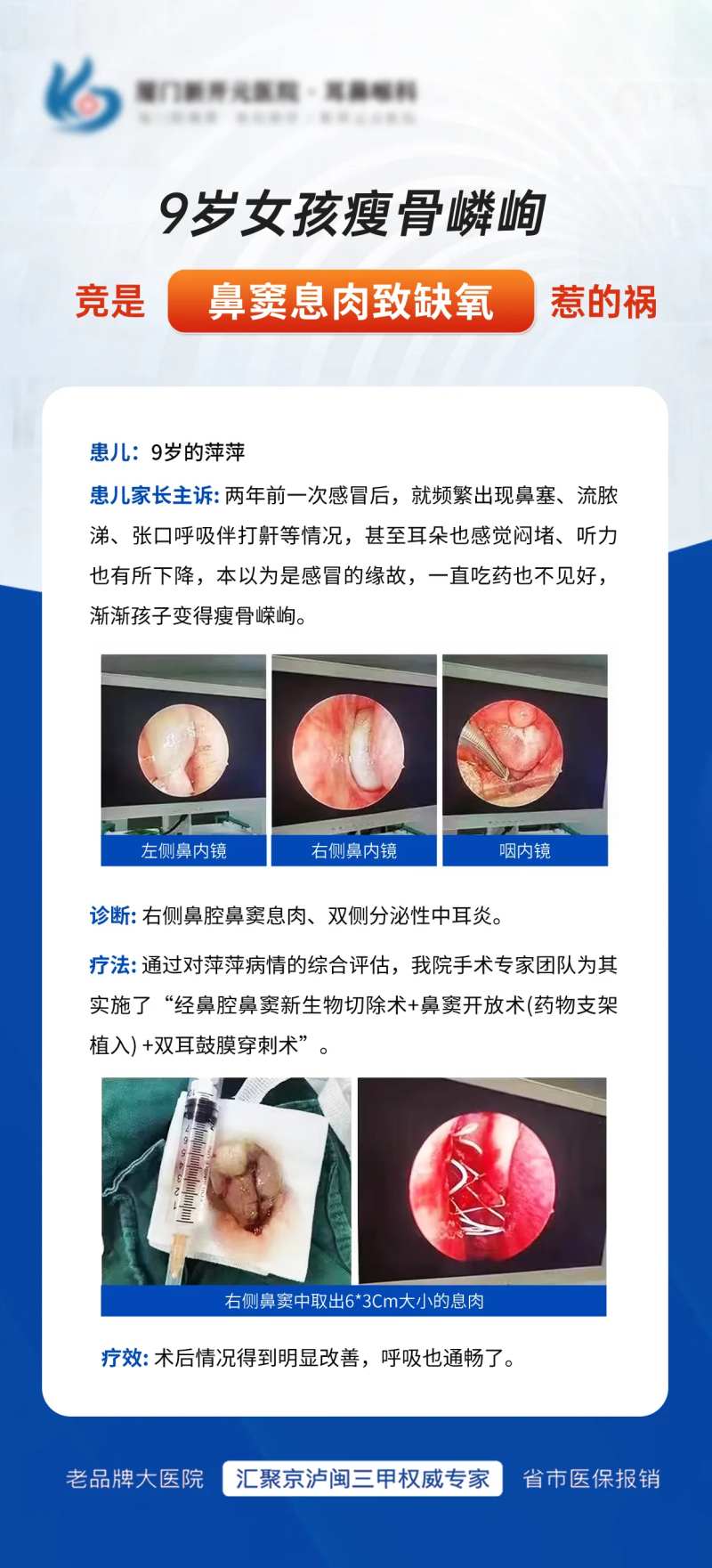 耳鼻喉鼻息肉海报-采灵感-cailinggan.com