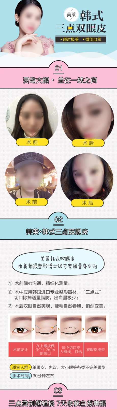 医美韩式双眼皮详情页-采灵感-https://www.cailinggan.com/