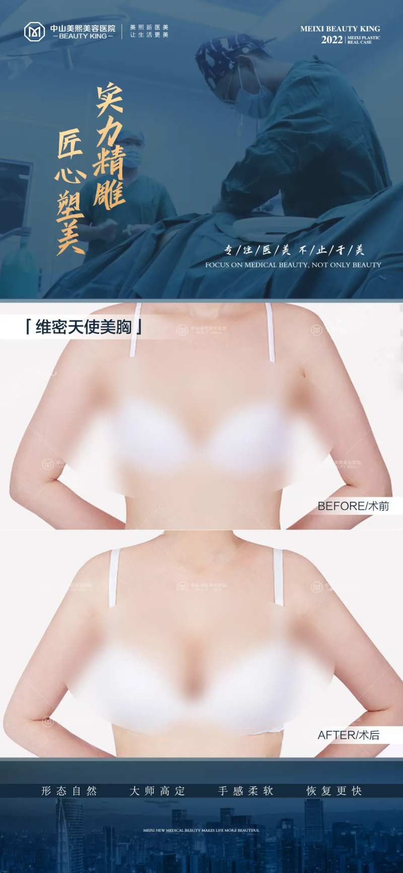 胸部整形案例海报-采灵感-cailinggan.com