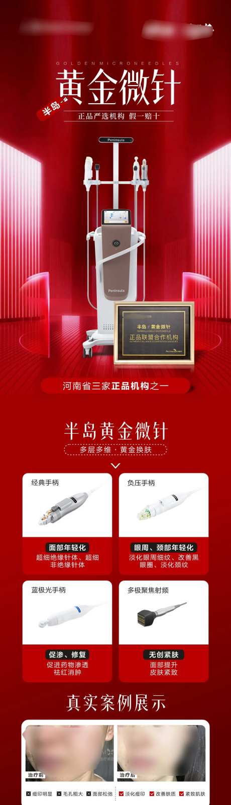 半岛黄金微针仪器案例宣传海报-采灵感-https://www.cailinggan.com/