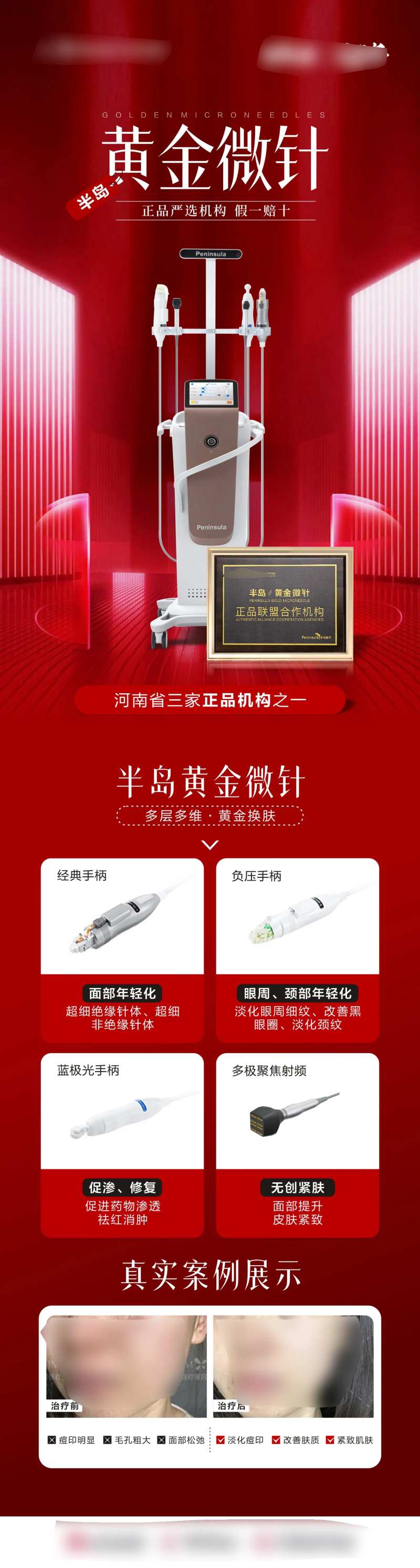 半岛黄金微针仪器案例宣传海报-采灵感-cailinggan.com