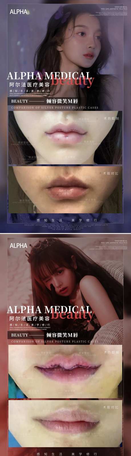 医美M唇案例系列海报-采灵感-https://www.cailinggan.com/