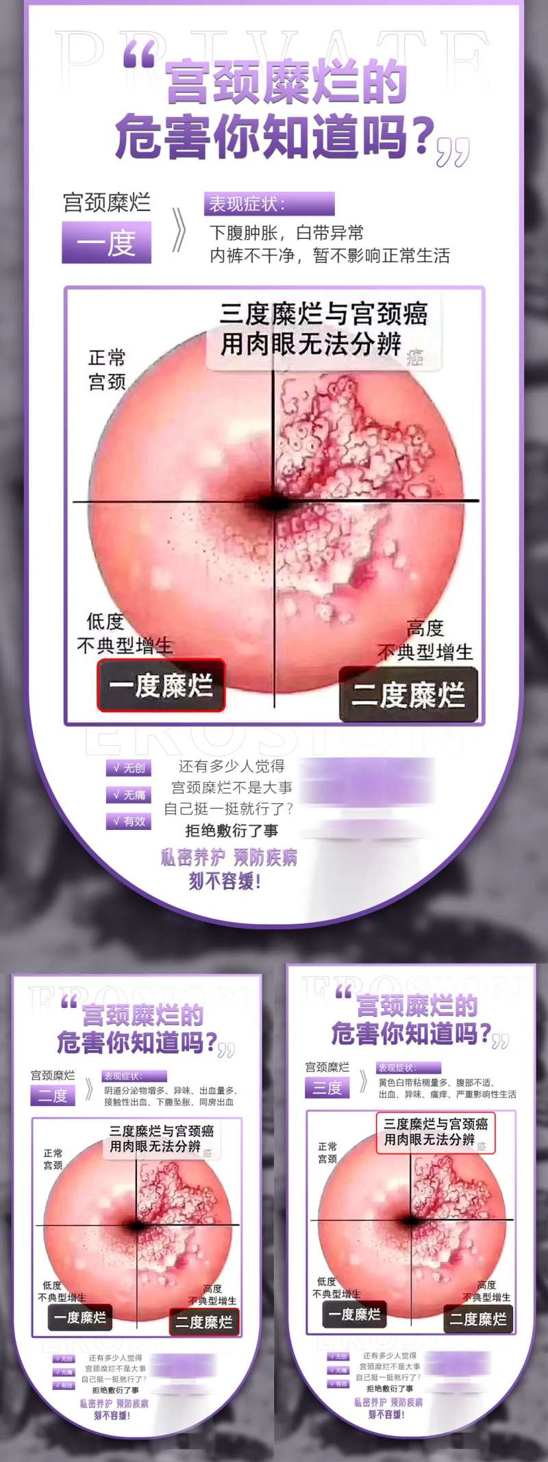 医美私密宫颈糜烂科普系列海报-采灵感-cailinggan.com