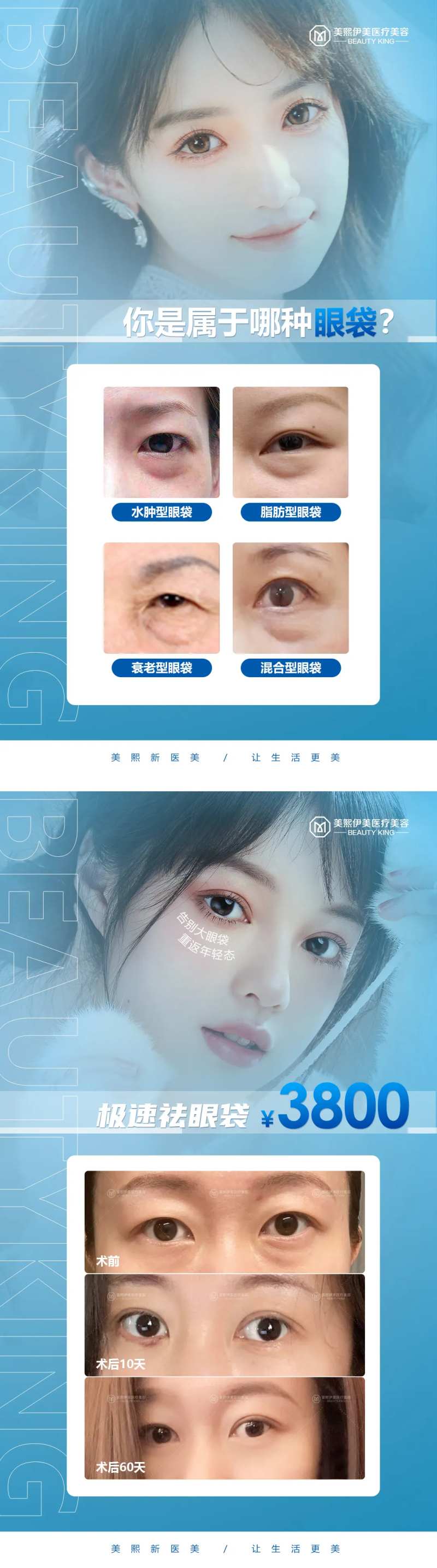 祛眼袋海报-采灵感-cailinggan.com