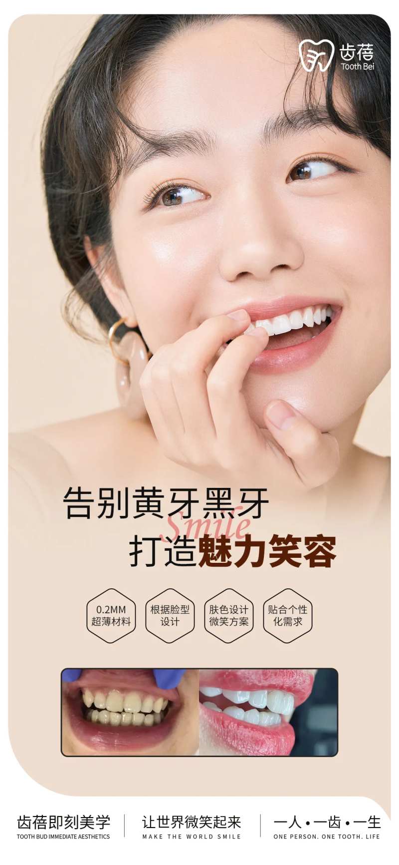 美业设计 牙齿海报设计 贴面 口腔-采灵感-cailinggan.com