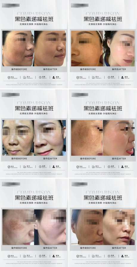淡斑案例系列海报-采灵感-https://www.cailinggan.com/