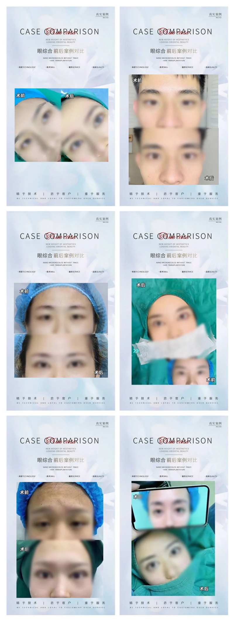 医美整形案例分享系列海报-采灵感-cailinggan.com