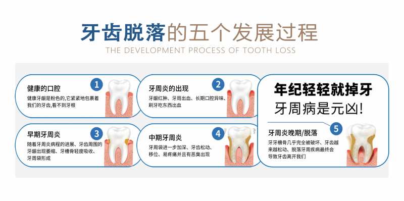 牙齿脱落的过程海报展板-采灵感-cailinggan.com