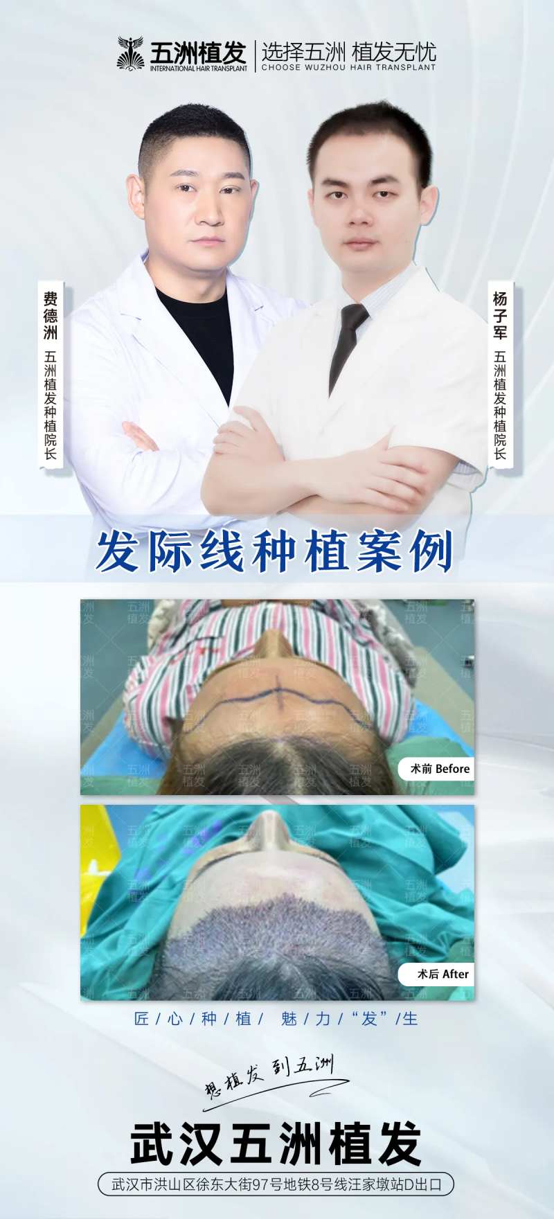 植发专家案例海报-采灵感-cailinggan.com