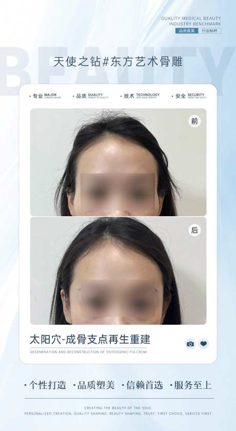 太阳穴案例对比海报-采灵感-https://www.cailinggan.com/