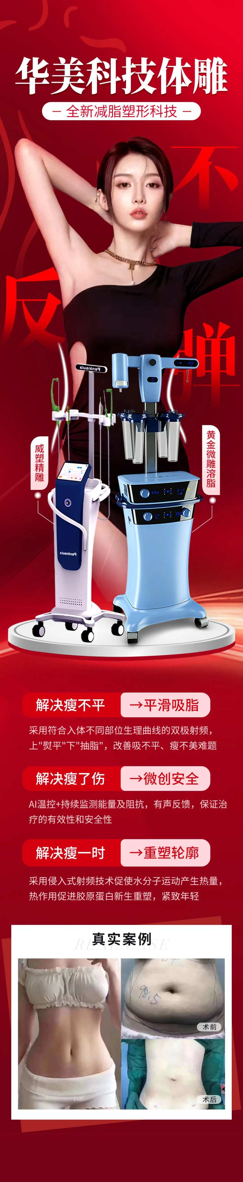 威塑体雕 吸脂  减脂-采灵感-cailinggan.com