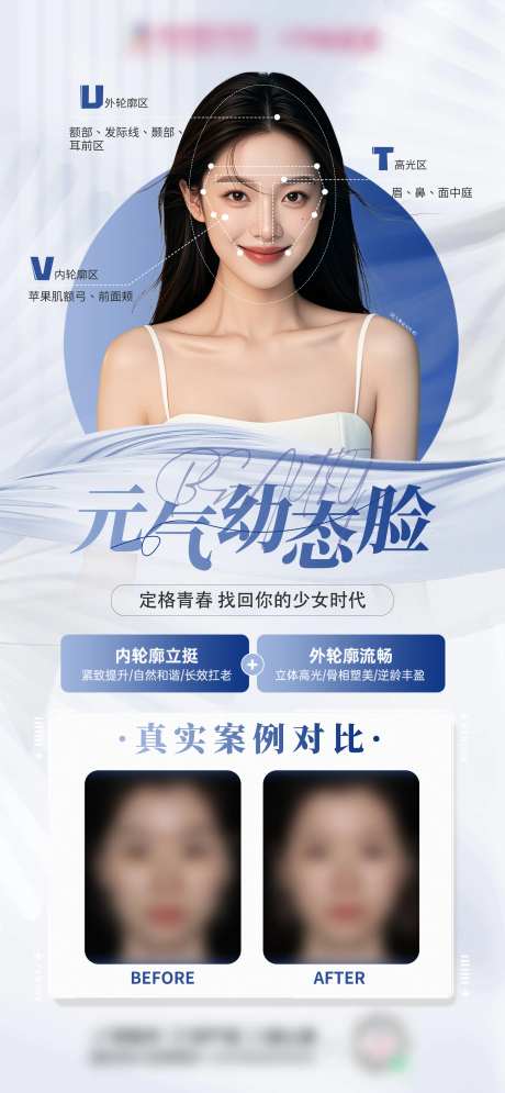 医美元气幼态脸-采灵感-https://www.cailinggan.com/