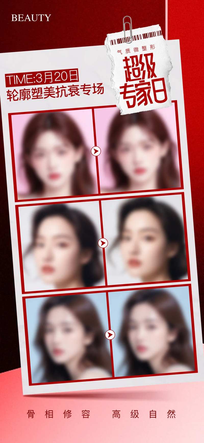 医美微整轻薄脸案例宣传海报-采灵感-cailinggan.com