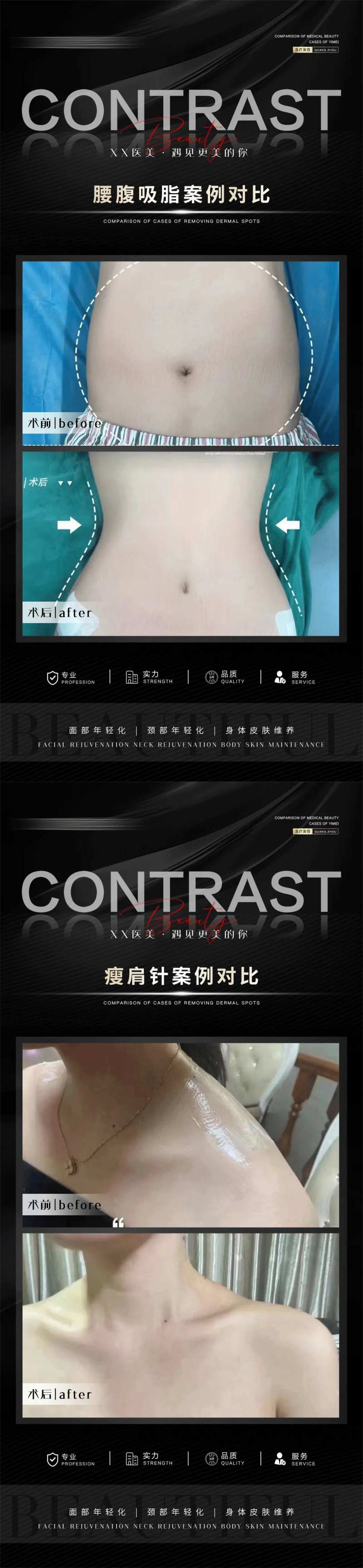 整形案例合集-采灵感-cailinggan.com