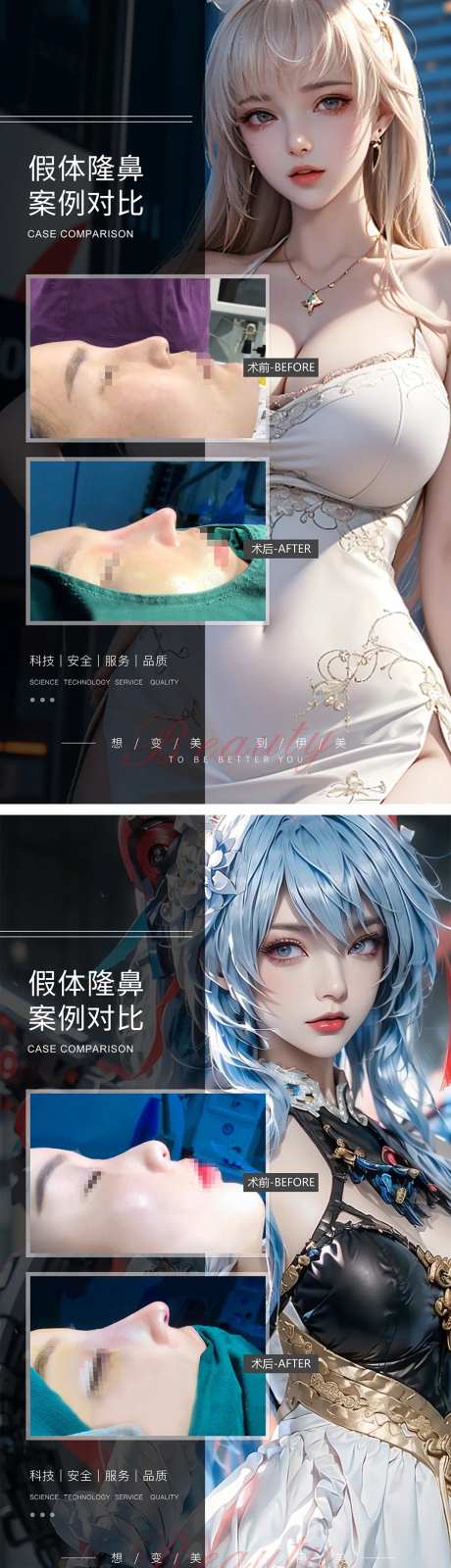 假体隆鼻案例对比-采灵感-https://www.cailinggan.com/