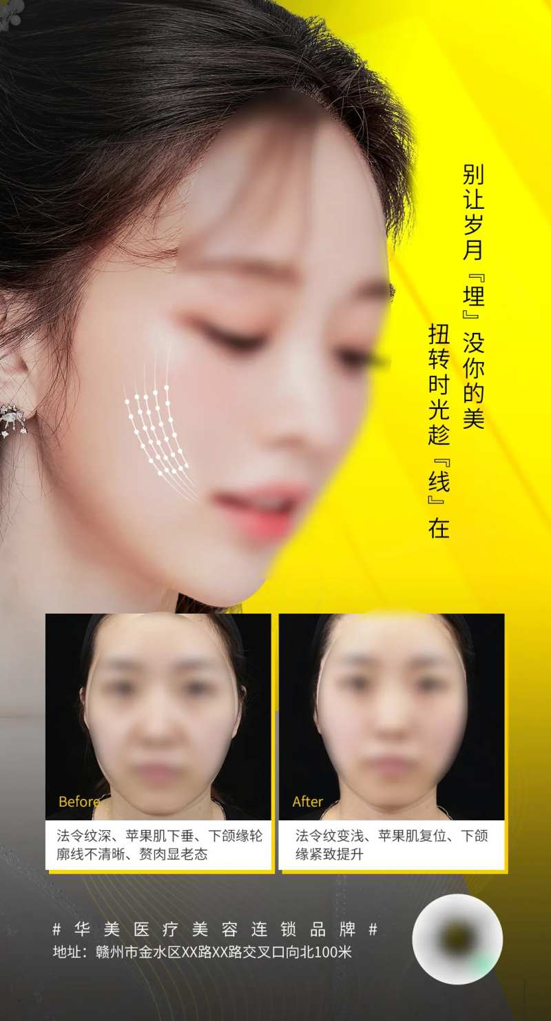 医美面部线雕案例海报-采灵感-cailinggan.com