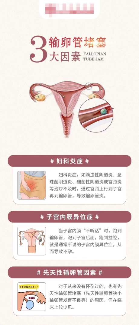 不孕科普输卵管堵塞海报-采灵感-https://www.cailinggan.com/