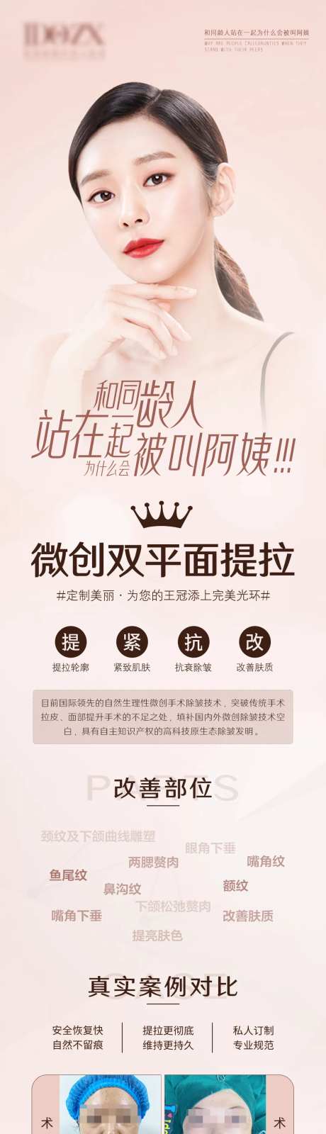 医美项目微创双平面-采灵感-https://www.cailinggan.com/