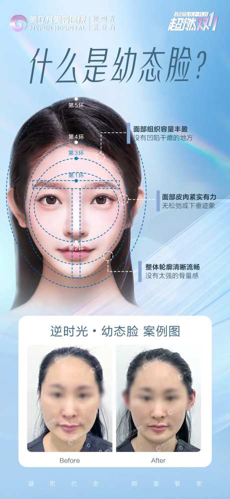 医美整形什么是幼态脸美女内轮廓和外轮-采灵感-https://www.cailinggan.com/