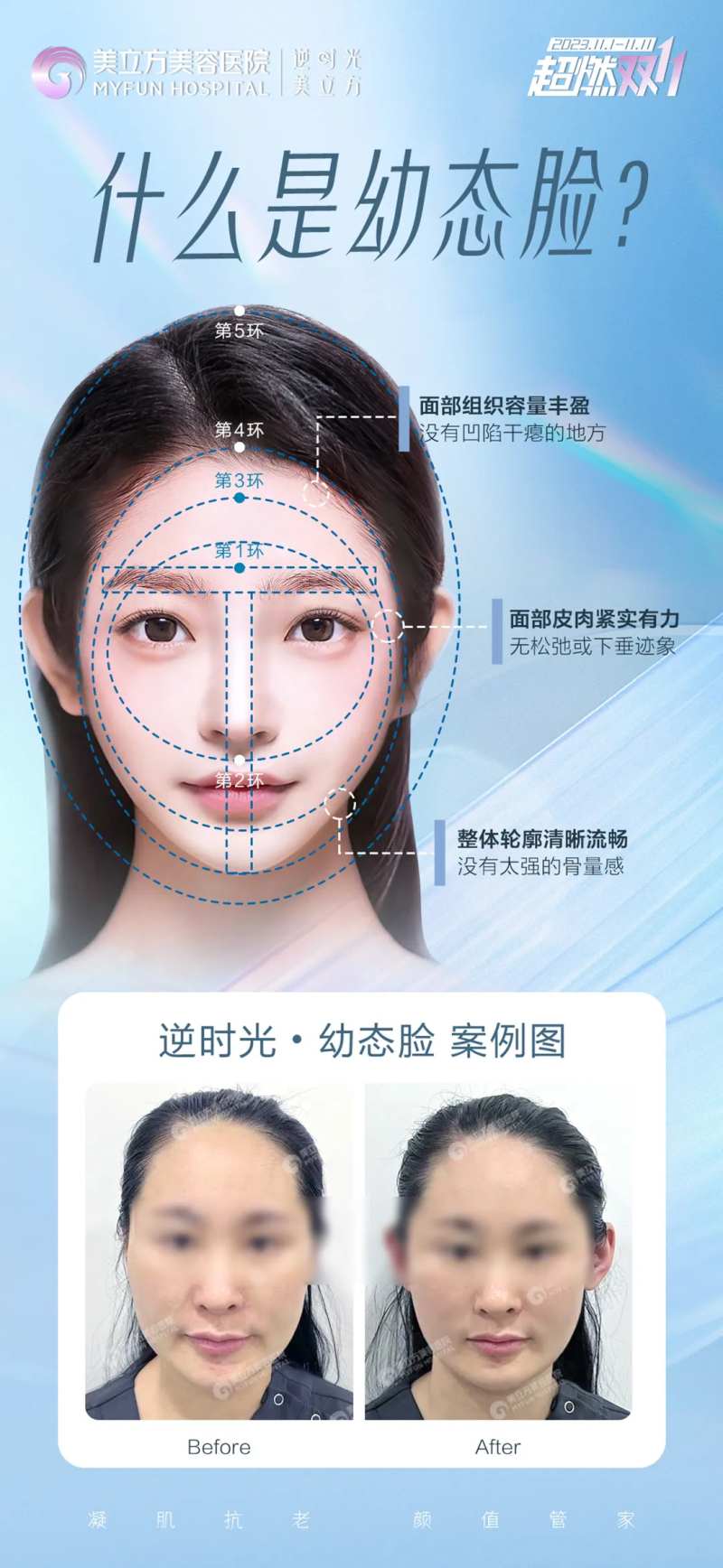 医美整形什么是幼态脸美女内轮廓和外轮-采灵感-cailinggan.com