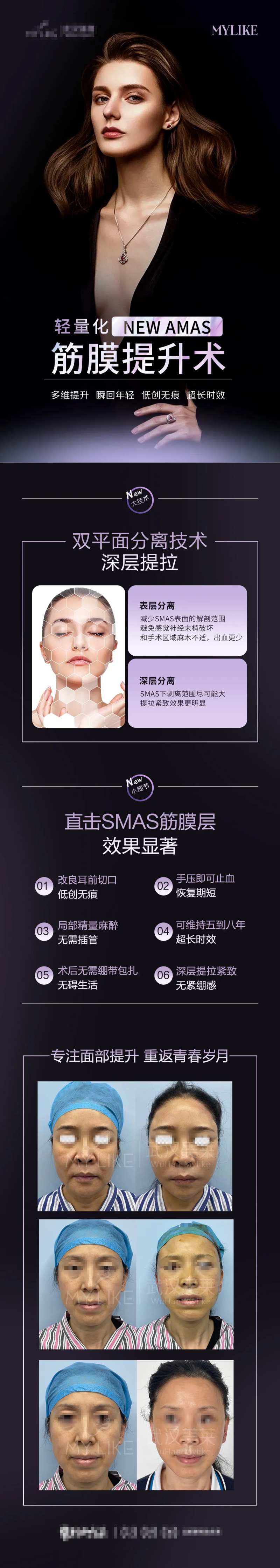 超声刀详情-采灵感-cailinggan.com