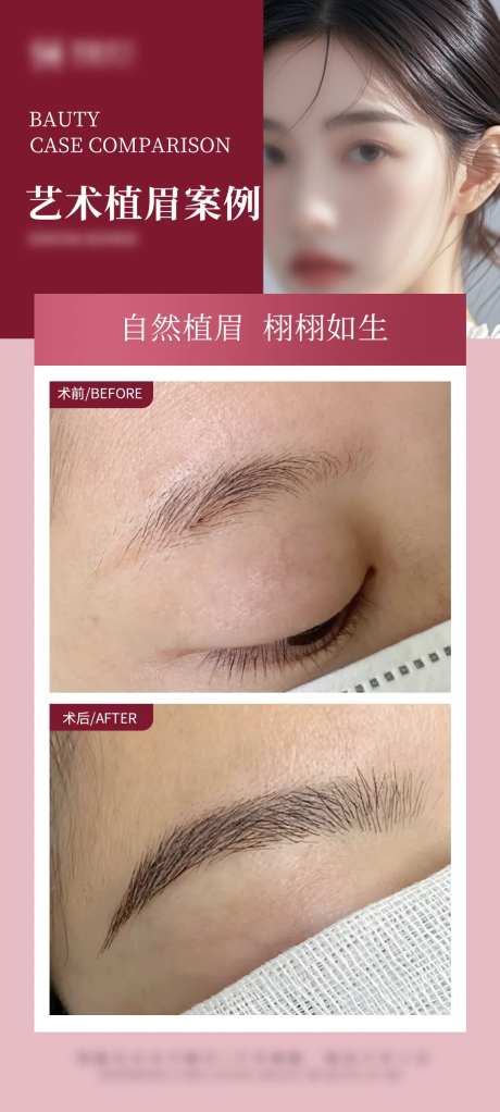 艺术植眉案例-采灵感-https://www.cailinggan.com/