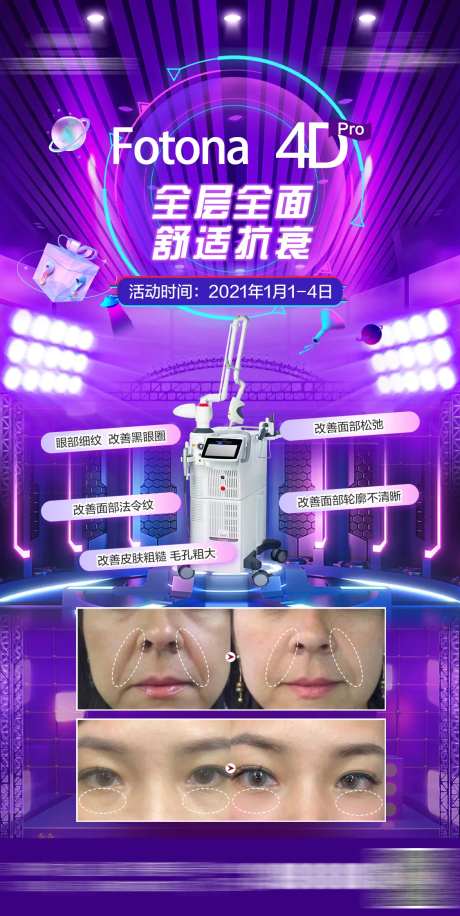 医美Fotona4D仪器海报-采灵感-https://www.cailinggan.com/