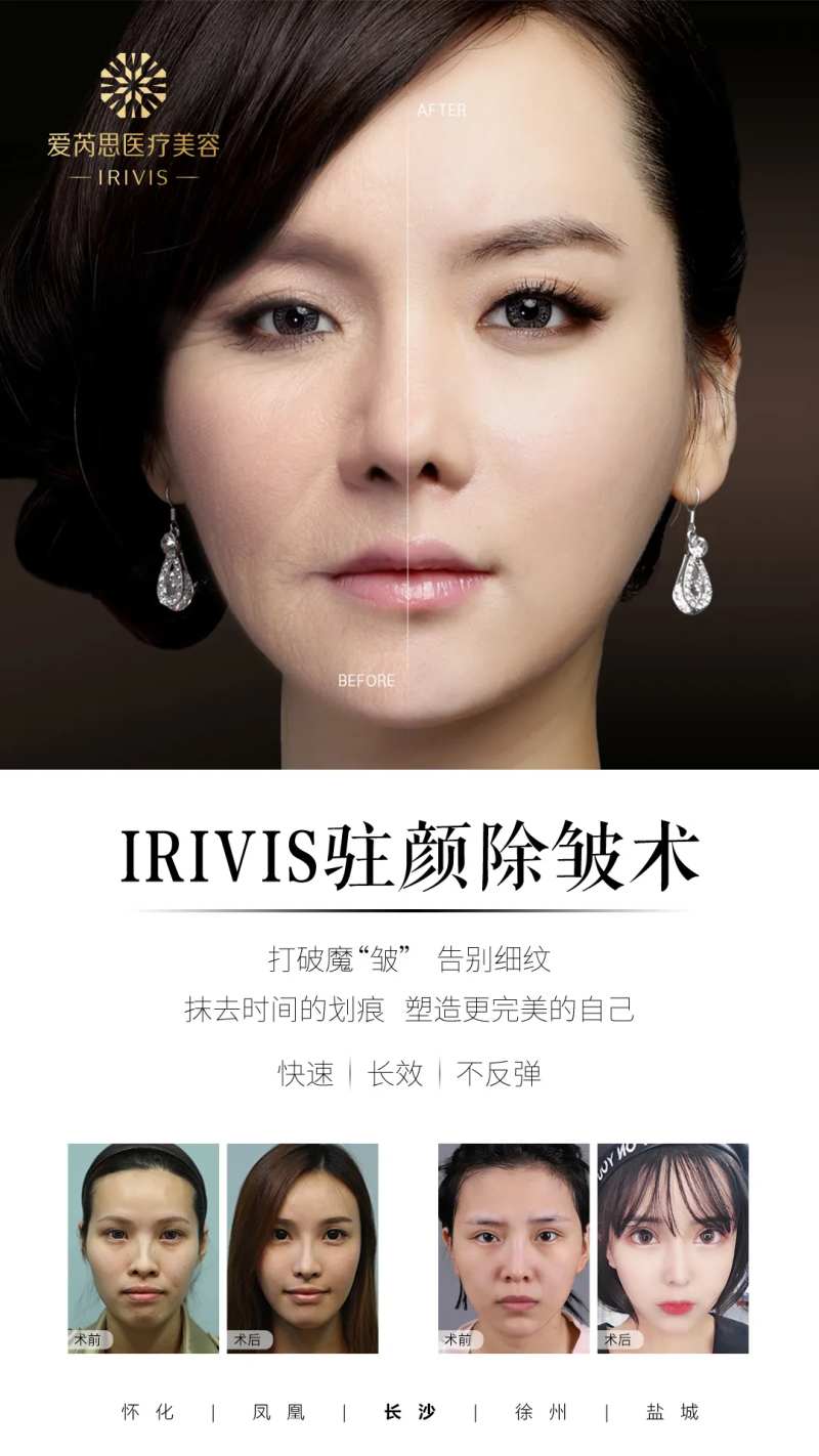 医美除皱抗衰简约海报-采灵感-cailinggan.com