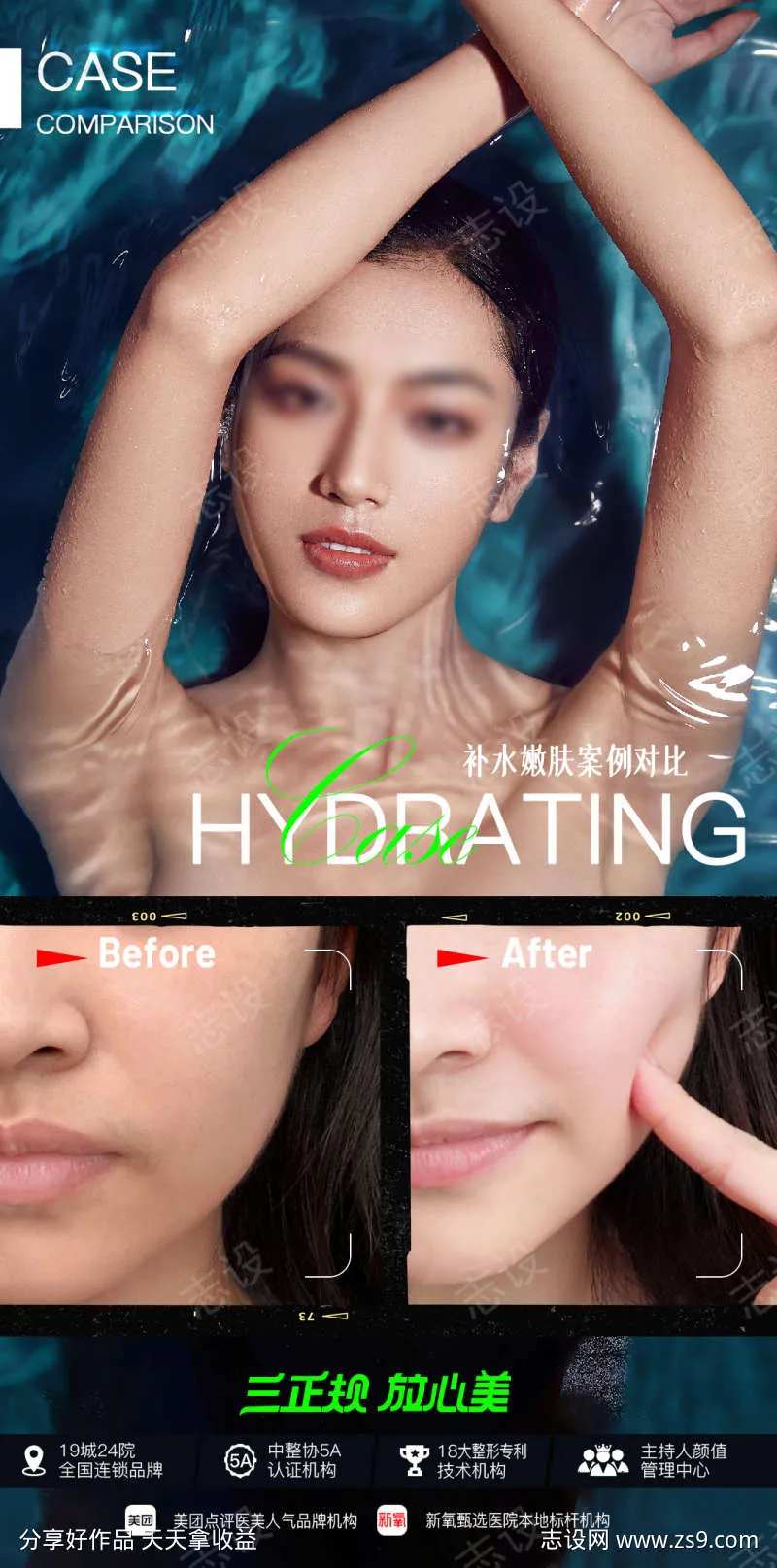 补水嫩肤案例对比-采灵感-cailinggan.com