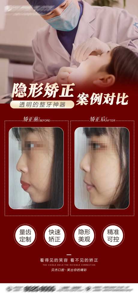 口腔隐形矫正案例海报-采灵感-https://www.cailinggan.com/
