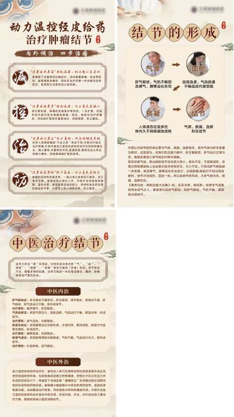 中医结节科普展架易拉宝-采灵感-https://www.cailinggan.com/