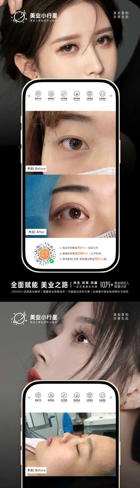 医美整形美容真人案例分享集-采灵感-https://www.cailinggan.com/