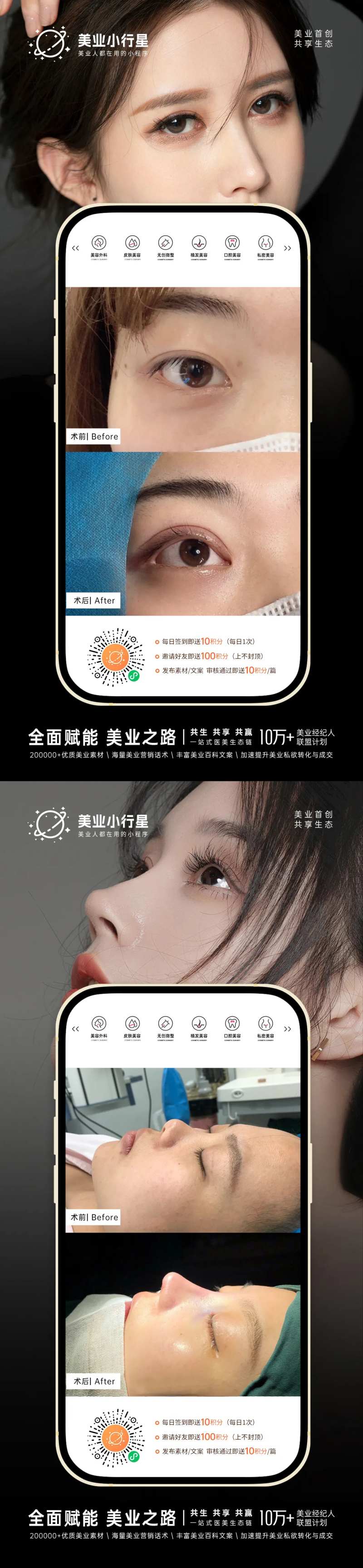 医美整形美容真人案例分享集-采灵感-cailinggan.com